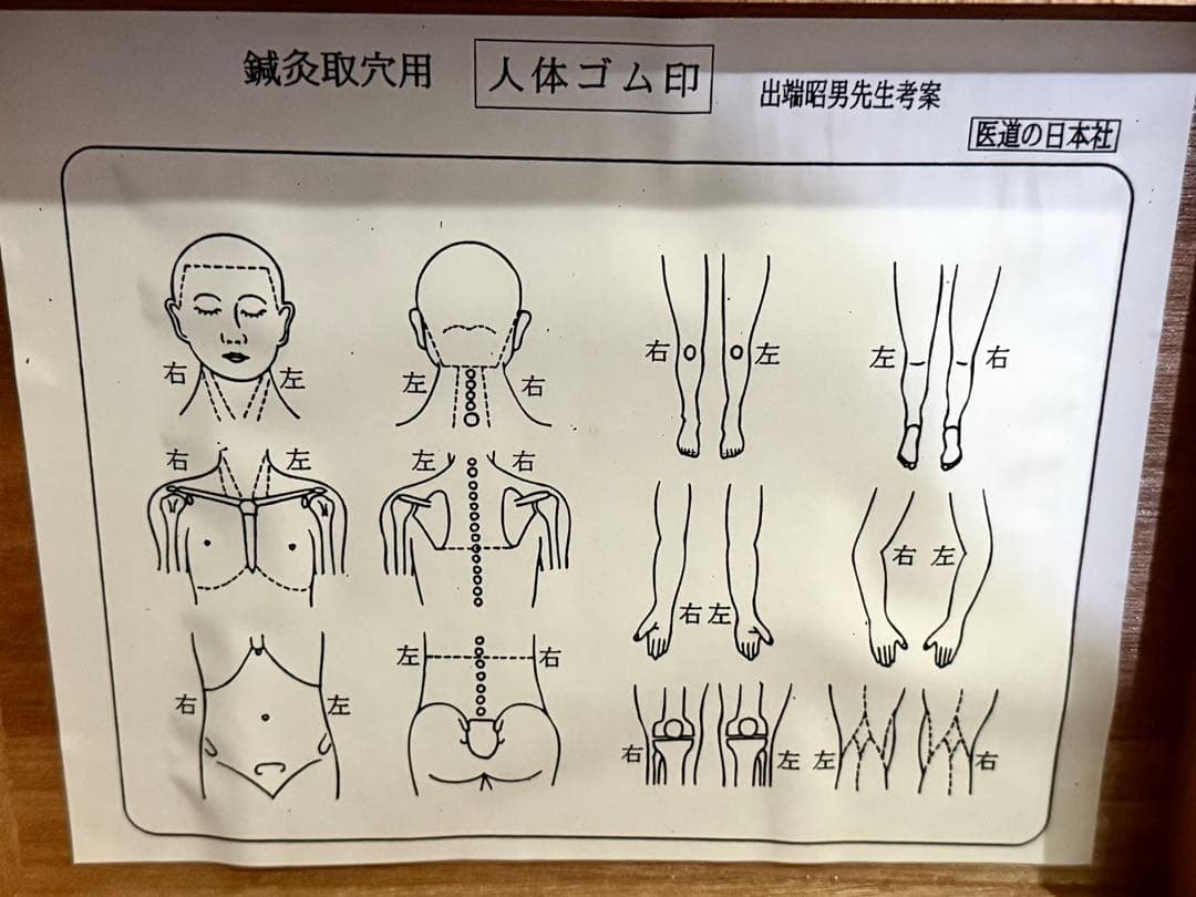 鍼灸用人体ゴム印（医道の日本社） Amazon.co.jp: 医道の日本社 鍼灸
